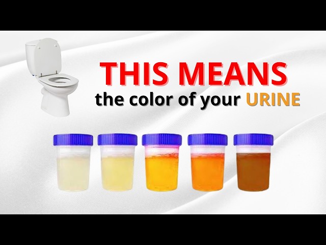 Did you know that the color of your URINE can reveal a lot about your health? 🚰💛