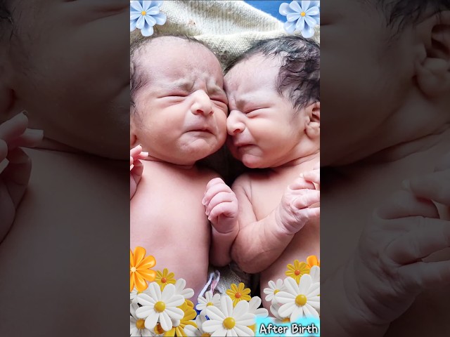 Cutest Twin Newborn Babies First Cry Lovely Moments @AfterBirth