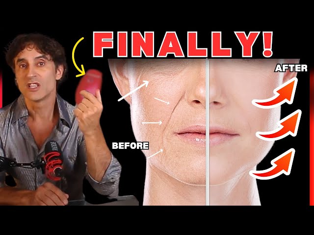 YOUR BEST RF At Home Skin Tightening Face Lifting Device // (( And Safest ))