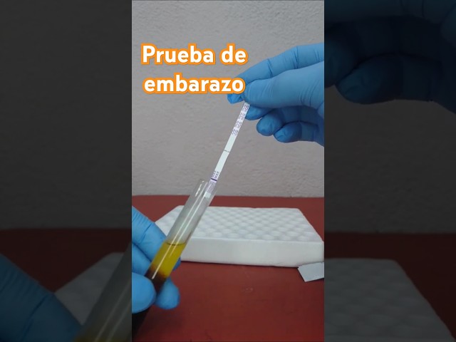 ¿Cómo se realiza una prueba de EMBARAZO en sangre? #shorts #embarazo #testdeembarazo