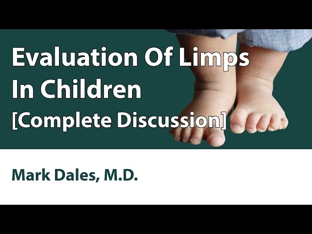 Evaluation Of Limps In Children [Complete Discussion]