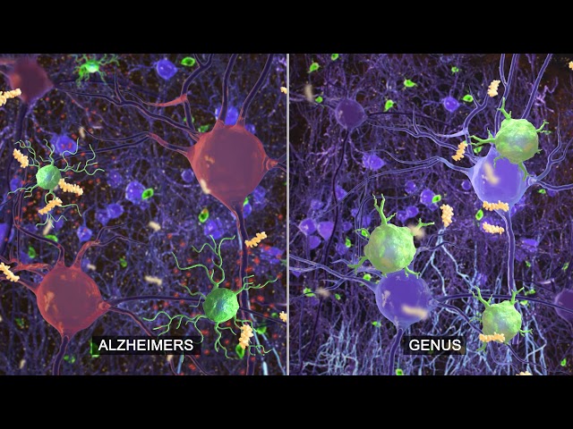 GENUS: Research on sensory stimulation to combat Alzheimer's disease