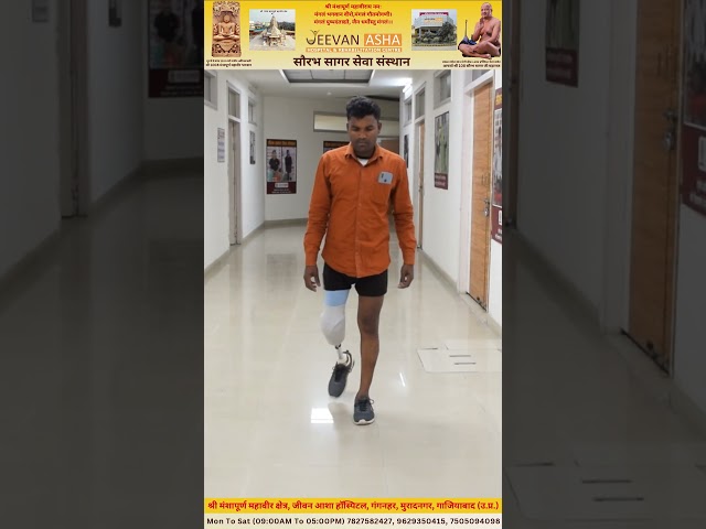 Sanoj lost right leg in a accident, JeevanAsha Hospital provided him free of cost Modular Prosthesis