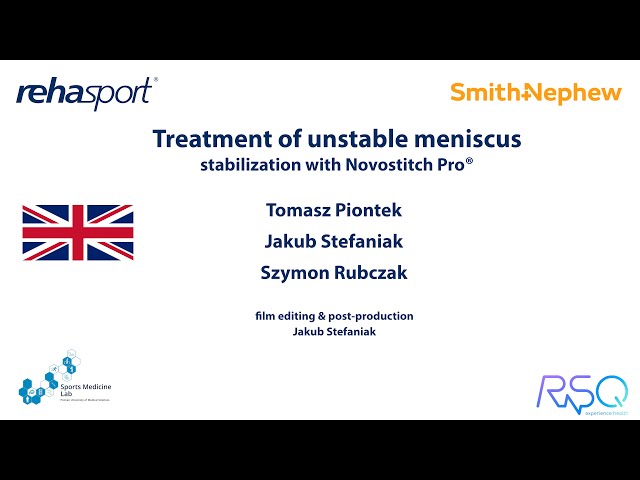 Treatment of unstable meniscus - stabilisation with Novostich® (ENG)