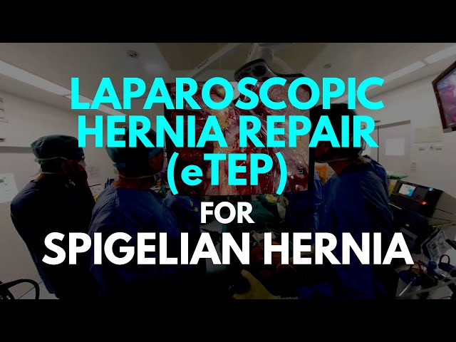 Laparoscopic Spigelian Hernia Repair in VR