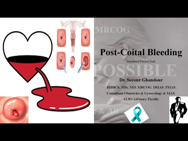 Post-Coital Bleeding - MRCOG Part 2 & 3 Tasks