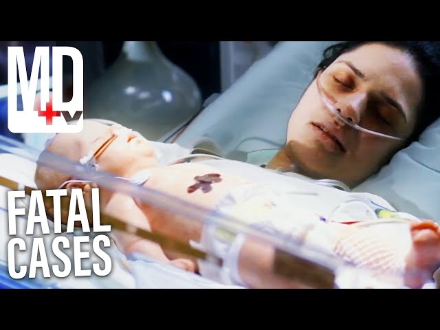 House Patients That Couldn’t Be Saved | House M.D | MD TV