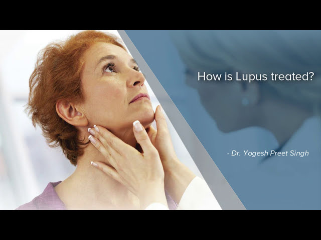 How Is Lupus Treated?| Lupus Treatment | Lupus Disease Treatment | Dr Yogesh Preet Singh| Manipal.