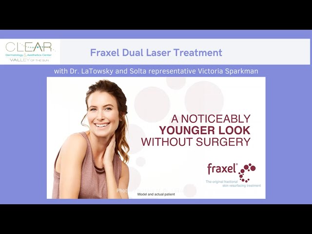 All About Fraxel Dual Laser Treatment