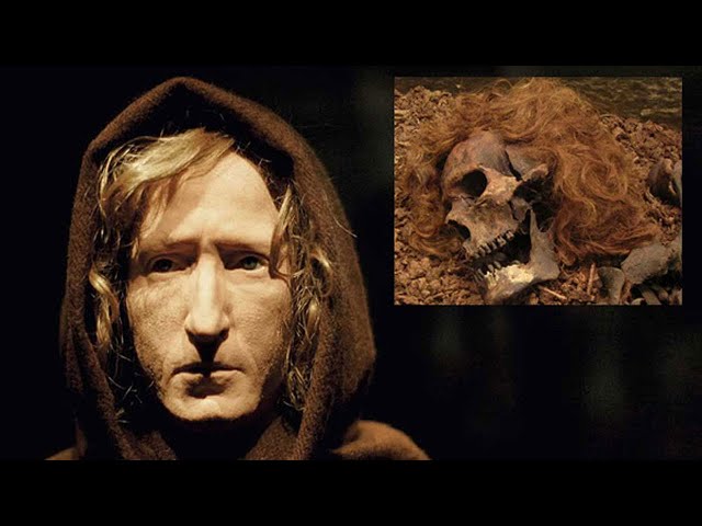 Most Mysterious Bog Bodies' Facial Reconstruction and Their Life Status Before