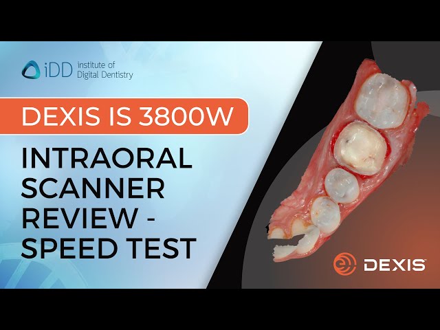 DEXIS IS 3800W Intraoral Scanner Review - Speed Test | iDD