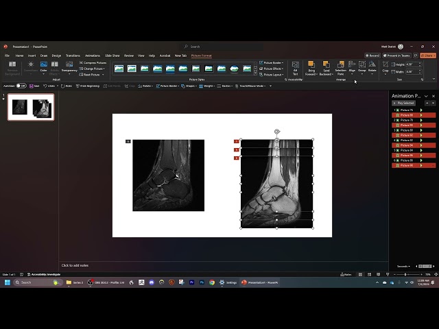 How to scroll two MRI or CT stacks together in powerpoint