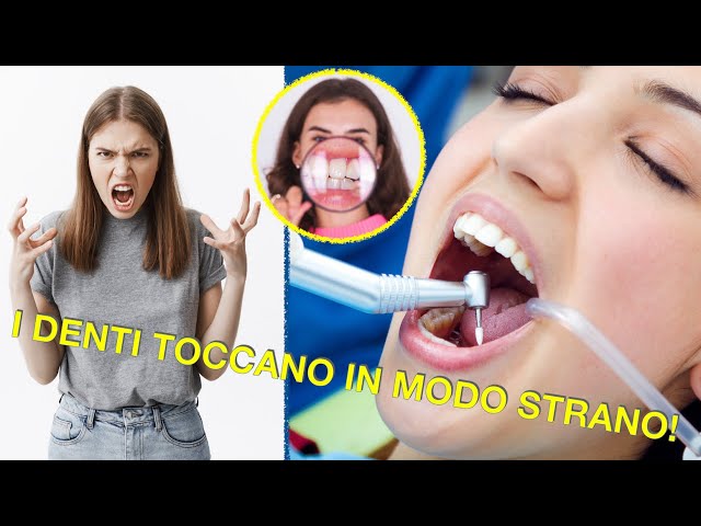 I denti toccano in modo strano!