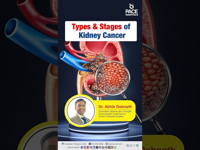 Kidney Cancer (Renal Carcinoma) - Type & Stage | Type of Kidney Cancer | Stage of Kidney Cancer