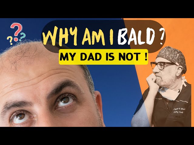 Hair Transplant in India if your DAD is not BALD!