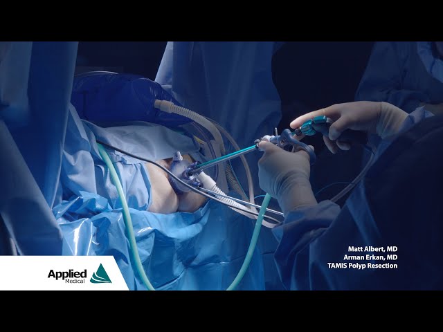 TAMIS Polyp Resection | Featuring the GelPOINT Path Transanal Access Platform