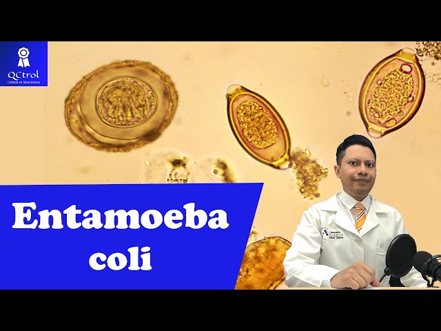 Meet Entamoeba coli: Mofology and CLUES for its identification, Parasitology Laboratory