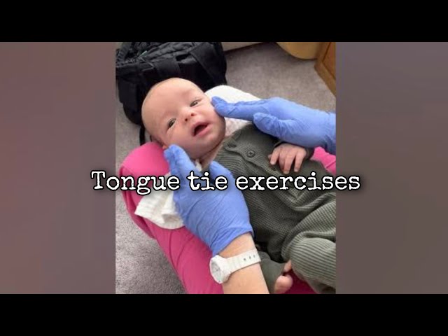 Tongue tie oral motor and body exercises for young baby