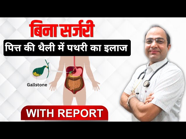 Gallbladder Stone without surgery homeopathic treatment | पित्ताशय की पथरी - कारण और उपचार |