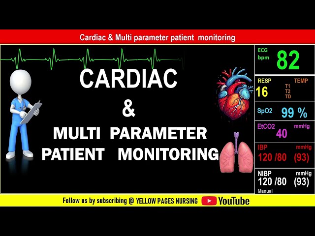 Cardiac & Multi parameter patient monitoring in ICU | Nursing Considerations