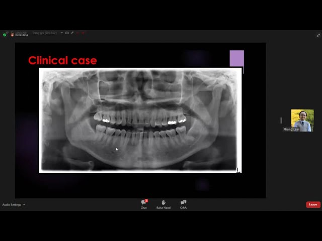 ỨNG DỤNG CỦA CBCT TRONG RĂNG HÀM MẶT |  Ts. Lâm Đại Phong VietDang