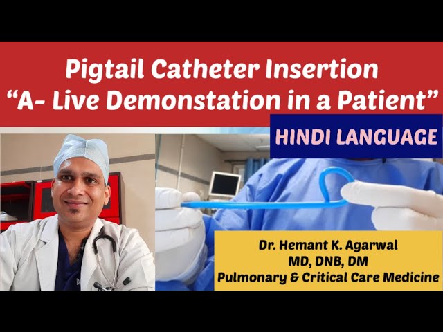 Pigtail Catheter Insertion (HINDI)- "A Live Demonstration in Pleural Effusion" @Dr. Hemant K Agarwal