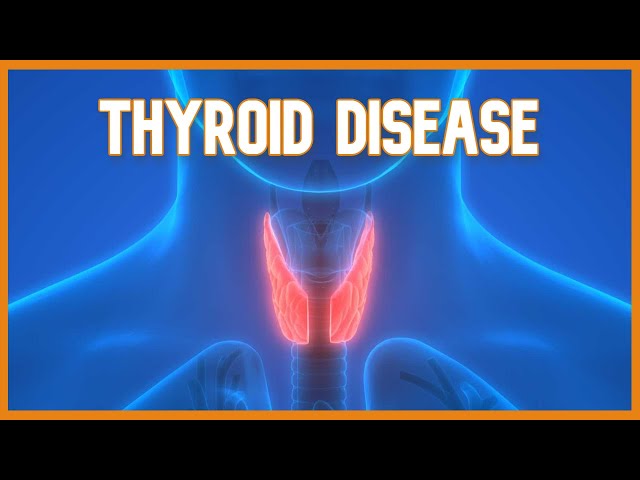 Thyroid Disease (Hyperthyroidism vs. Hypothyroidism)