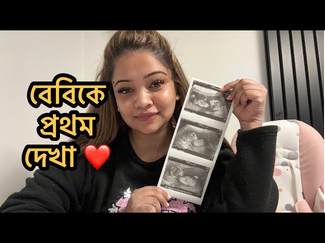 First look of our Baby|একাই প্রথম বেবিকে দেখলাম||Daily Vlog|ভেবেছিলাম এইবার অন্তত এতো খারাপ লাগবেনা