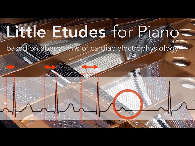 Little Etudes for piano based on aberrations of cardiac electrophysiology