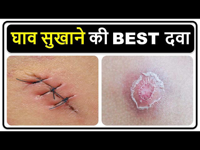 Best Medicine Detail Hindi Video Medical lecture