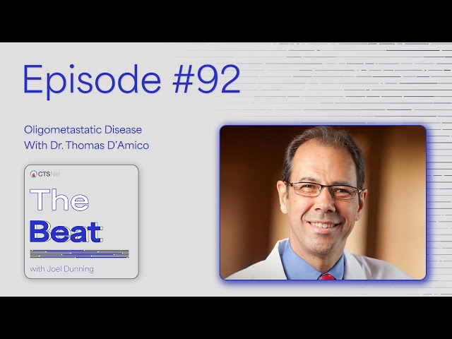 The Beat With Joel Dunning Ep. 92: Oligometastatic Disease