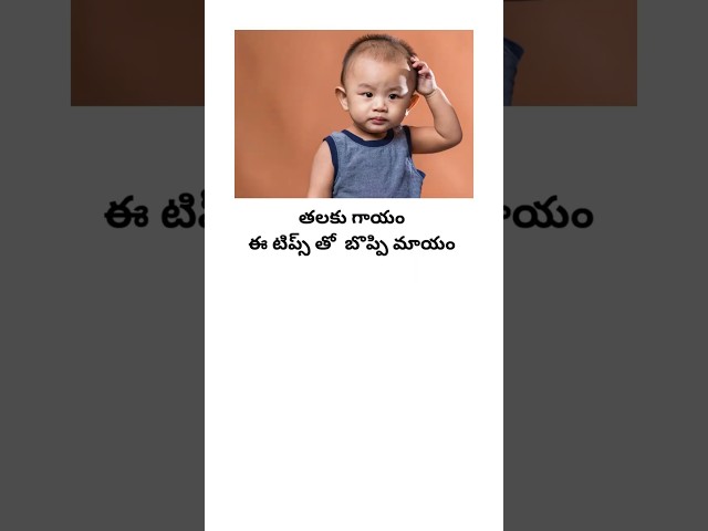 బేబీ తలకు గాయం బొప్పి కడితే ఇలా చేయండి  | Women & Child Health