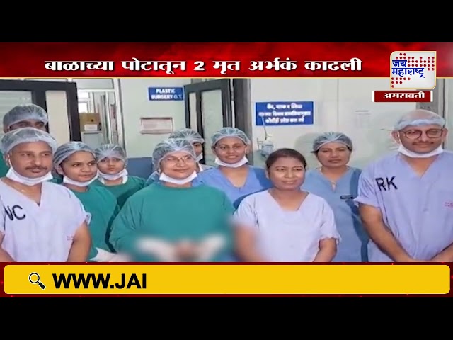 Buldhana Viral Baby News | बुलढाण्यातील बाळाच्या पोटात गर्भ असल्याचं प्रकरण | Marathi News