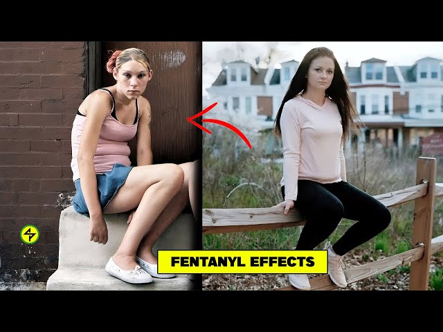 Effects of a Fentanyl Overdose in Kensington | Philadelphia drug addicts street January!!!