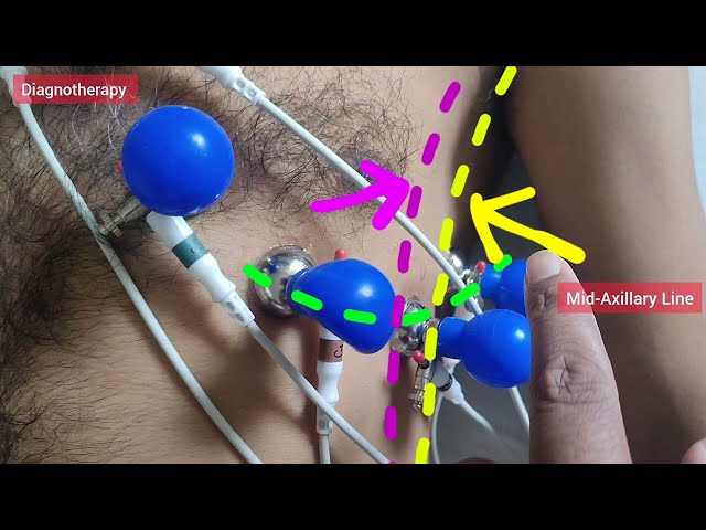 How to take ECG | How to do ECG | 12 Lead ECG