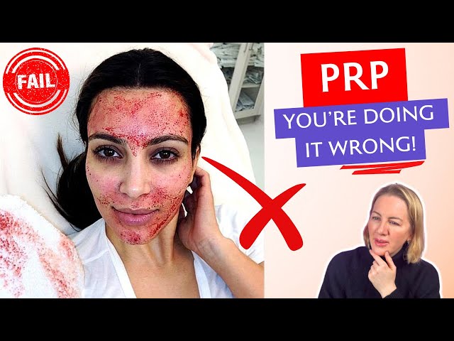 PRP Unspun: Everything You Need to Know About Platelet-Rich Plasma Therapy! #prp