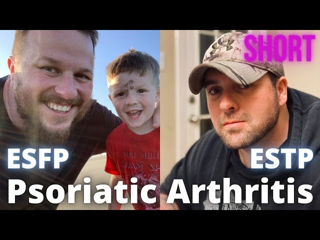 (Short) Psoriatic Arthritis in the ESFP and ESTP w/ Brady Jones Sensors Uncensored & Clay Crawford