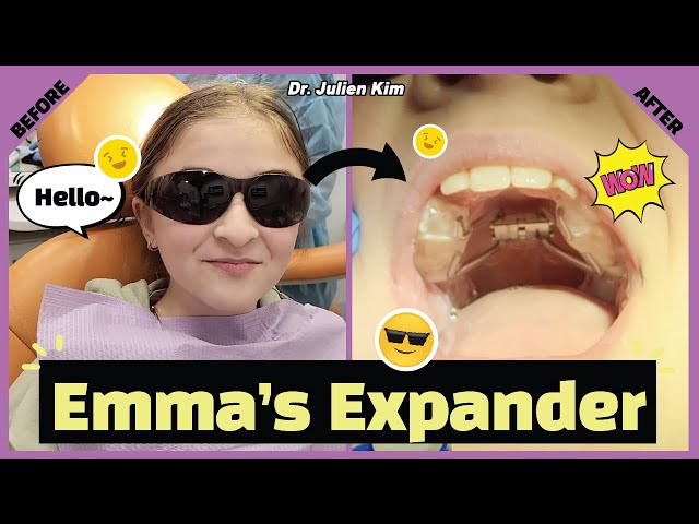 Emma's Expander: What DOES IT do? 악궁확장장치는 언제 쓰이는건가요?