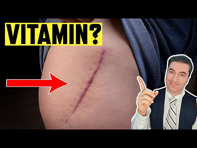 The most powerful VITAMIN to avoid HIP surgery!