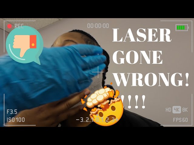 LASER GONE WRONG?!!