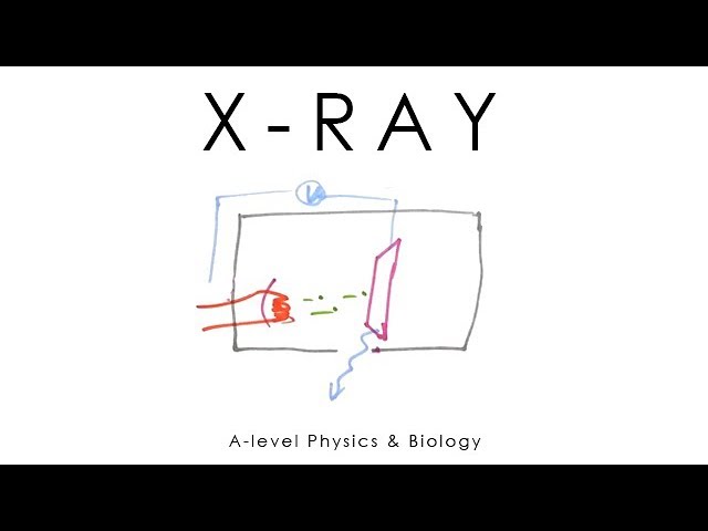 X-ray Scanning - A-level Physics