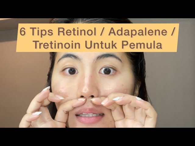 HINDARI 6 Hal Ini Kalau Kamu Baru Mulai Pakai Retinol / Adapalene / Tretinoin !!