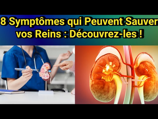 Warning: These 8 Symptoms May Signal a Serious Kidney Problem!