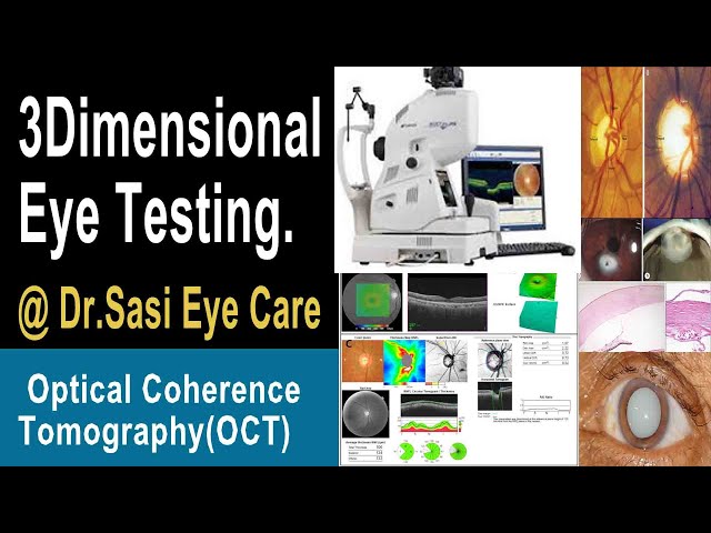 Optical Coherence Tomography( OCT MACHINE ) 3D Eye Testing to know all about eye defects.