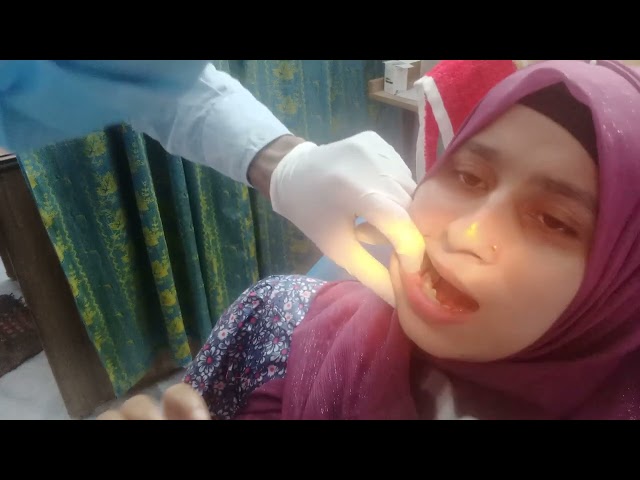 lower right side second premolars ans fast molars RCT process 2and  Final...