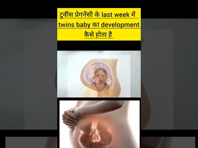 Twins pregnancy ke last weeks me twins baby ka development kaise hota hai twins pregnancy in hindi