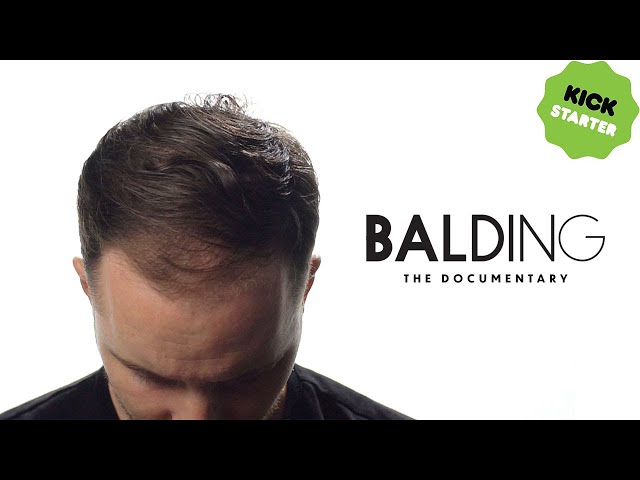 Balding Kickstarter | Documentary