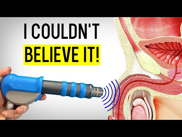 My patient Took Shockwave Therapy For 3 Month to Cure ED, Here's What Happened