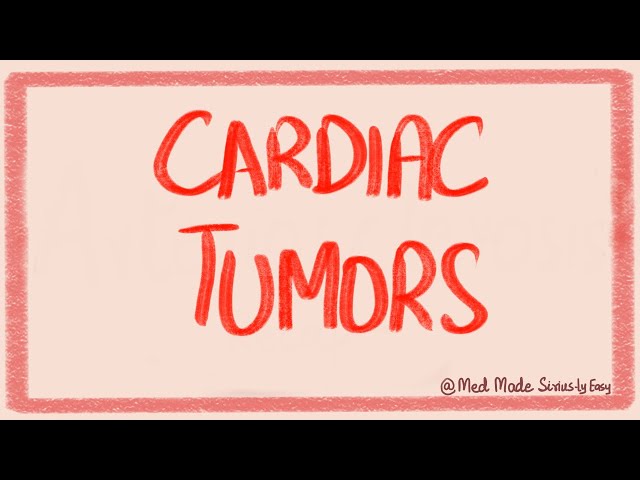 Cardiac Tumors- Myxomas, Rhabdomyomas and Metastatic Tumors- Cardiac Pathology