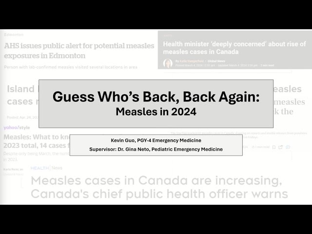 Guess who's Back, Back again Measles in 2024